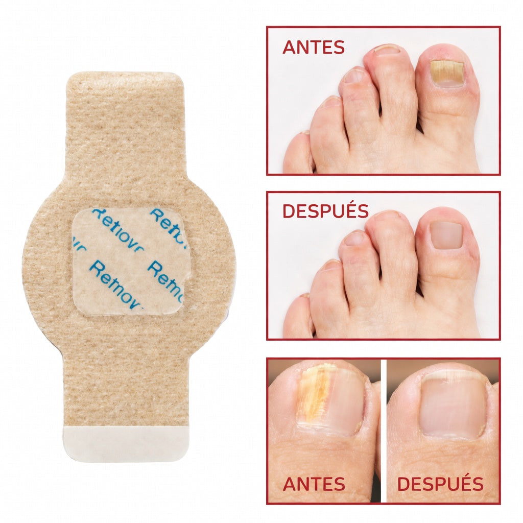 Parches Regeneradores de uñas - BIG PACK 21/UN
